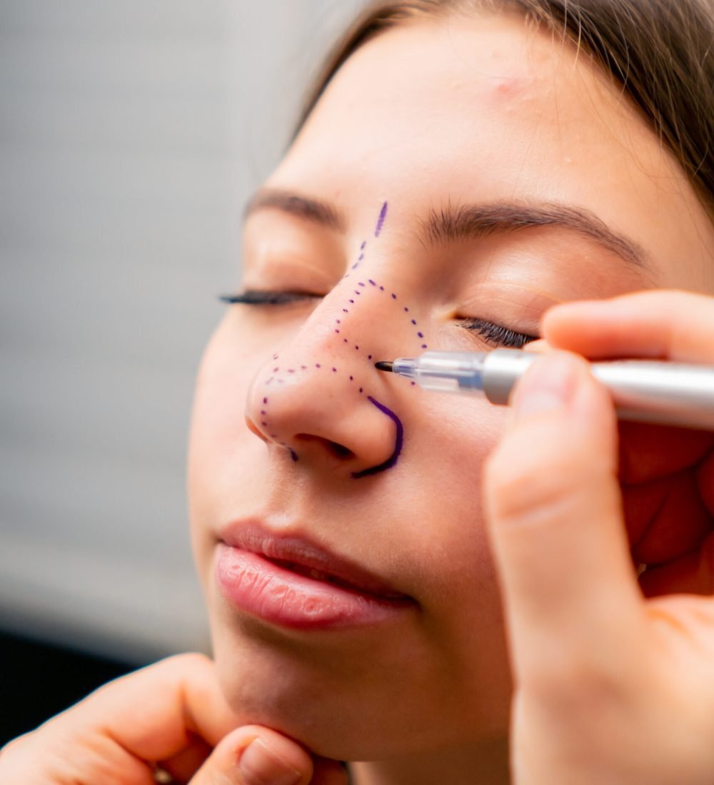 close-up plastic surgeon makes marks on a patient's face during a consultation before nose operation